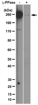 Anti-RNA polymerase II subunit B1 (phospho-CTD Ser-5) Antibody, clone 3E8