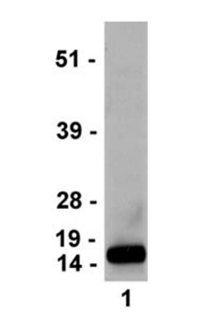 Anti-trimethyl-Histone H3 (Lys4) Antibody, clone MC315, rabbit monoclonal