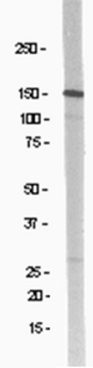 Anti-NR2B Antibody