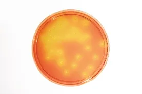 HEIMPLATE™Mannitol Salt Agar