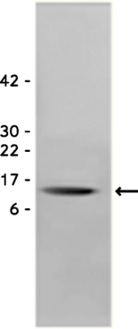 Brain Derived Neurotrophic Factor, recombinant