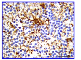 Anti-Glial Fibrillary Acidic Protein Antibody, clone GA5