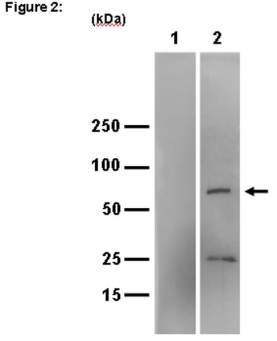 RIPAb+™ IGF2 mRNA-binding protein 3