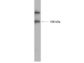 ANTI-GLUR1 RECOMBINANT MONOCLONAL