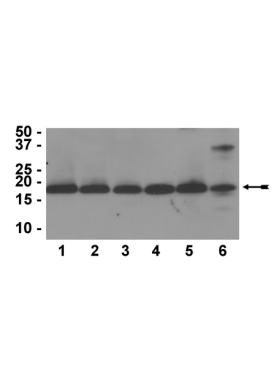 Anti-Hist H3, CT, pan, cl A3S   100ul