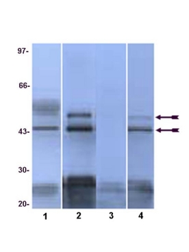 Anti-ph JNK Thr183/Tyr185,Thr221/Tyr223