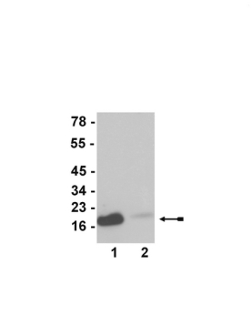 A-ACET-HIST H3(K23), CHIP GRD 100UL