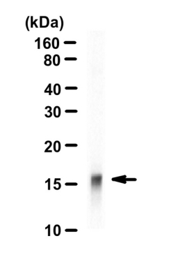 A-ACET-HIST   H3(K27)     100UL