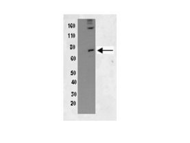 anti-phospho-PKR (Thr451)