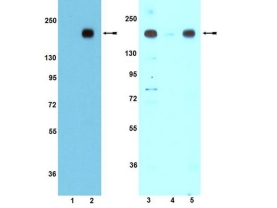 ANTI PHOSPHO IRS1 (Y612)