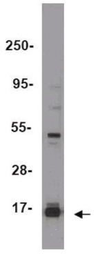 ChIPAb+ Trimethyl-Histone H3 (Lys27)