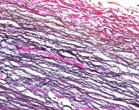 Picrofuchsin solution acc. to van Gieson for Microscopy