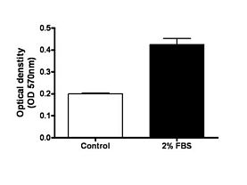 QCM™ Endothelial Cell Invasion Assay (24 well, colorimetric)