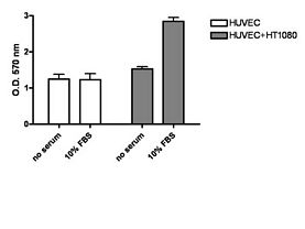 QCM™ Tumor Cell Transendothelial Migration Assay (Colorimetric, 24 Assays)