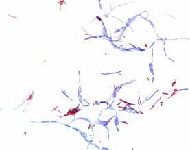 Ziehl-Neelsen carbol-fuchsin solution for microscopy