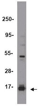 ChIPAb+ Trimethyl-Histone H3 (Lys27) - ChIP Validated Antibody and Primer Set