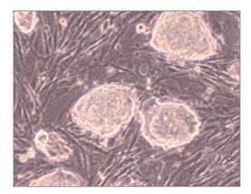 EmbryoMax® PMEF P1 Neo Resist, Untreated